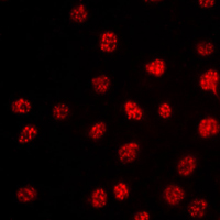 Immunofluorescent analysis of TBX15/18 staining in HepG2 cells. Formalin-fixed cells were permeabilized with 0.1% Triton X-100 in TBS for 5-10 minutes and blocked with 3% BSA-PBS for 30 minutes at room temperature. Cells were probed with the primary antibody in 3% BSA-PBS and incubated overnight at 4 C in a humidified chamber. Cells were washed with PBST and incubated with a DyLight 594-conjugated secondary antibody (red) in PBS at room temperature in the dark. DAPI was used to stain the cell nuclei (blue).