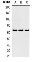Western blot analysis of TBX18 expression in Jurkat (A); NIH3T3 (B); PC12 (C) whole cell lysates.