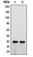 Western blot analysis of ATP6V0D1 expression in HeLa (A); H9C2 (B) whole cell lysates.