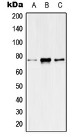 Western blot analysis of Kv7.4 expression in HeLa (A); mouse liver (B); rat liver (C) whole cell lysates.