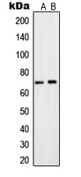 Western blot analysis of CNT2 expression in A549 (A); HepG2 (B) whole cell lysates.