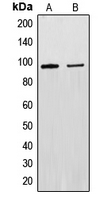 Western blot analysis of EXO1 expression in Raw264.7 (A); A431 (B) whole cell lysates.