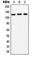 Western blot analysis of NCKX1 expression in HeLa (A); SP2/0 (B); NIH3T3 (C) whole cell lysates.