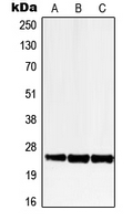 Western blot analysis of LRAT expression in HEK293T (A); SP2/0 (B); H9C2 (C) whole cell lysates.