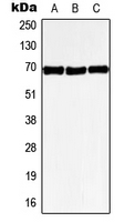 Western blot analysis of GPR50 expression in HeLa (A); SP2/0 (B); PC12 (C) whole cell lysates.