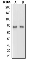 Western blot analysis of Netrin 1 expression in rat brain (A); PC12 (B) whole cell lysates.