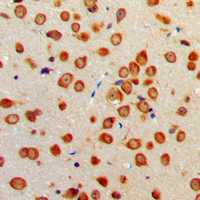 Immunohistochemical analysis of Netrin 1 staining in human brain formalin fixed paraffin embedded tissue section. The section was pre-treated using heat mediated antigen retrieval with sodium citrate buffer (pH 6.0). The section was then incubated with the antibody at room temperature and detected using an HRP conjugated compact polymer system. DAB was used as the chromogen. The section was then counterstained with haematoxylin and mounted with DPX.