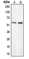 Western blot analysis of CHST2 expression in HepG2 (A); COLO205 (B) whole cell lysates.