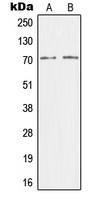 Western blot analysis of CRSP7 expression in HEK293T (A); HeLa (B) whole cell lysates.