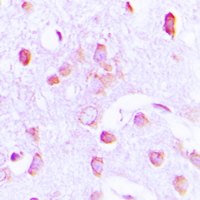 Immunohistochemical analysis of PERK staining in human brain formalin fixed paraffin embedded tissue section. The section was pre-treated using heat mediated antigen retrieval with sodium citrate buffer (pH 6.0). The section was then incubated with the antibody at room temperature and detected using an HRP conjugated compact polymer system. DAB was used as the chromogen. The section was then counterstained with haematoxylin and mounted with DPX.