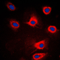 Immunofluorescent analysis of PERK staining in HeLa cells. Formalin-fixed cells were permeabilized with 0.1% Triton X-100 in TBS for 5-10 minutes and blocked with 3% BSA-PBS for 30 minutes at room temperature. Cells were probed with the primary antibody in 3% BSA-PBS and incubated overnight at 4 C in a humidified chamber. Cells were washed with PBST and incubated with a DyLight 594-conjugated secondary antibody (red) in PBS at room temperature in the dark. DAPI was used to stain the cell nuclei (blue).