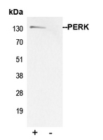Immunoprecipitation of PERK from 0.5mg Hela whole cell extract lysate using 5ug of Anti-PERK Antibody and 50ul of protein G magnetic beads (+). No antibody was added to the control (-). The antibody was incubated under agitation with Protein G beads for 10min Hela whole cell extract lysate diluted in RIPA buffer was added to each sample and incubated for a further 10min under agitation. Proteins were eluted by addition of 40ul SDS loading buffer and incubated for 10min at 70 C; 10ul of each sample was separated on a SDS PAGE gel transferred to a nitrocellulose membrane blocked with 5% BSA and probed with Anti-PERK Antibody.