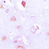 Immunohistochemical analysis of FXR2 staining in human brain formalin fixed paraffin embedded tissue section. The section was pre-treated using heat mediated antigen retrieval with sodium citrate buffer (pH 6.0). The section was then incubated with the antibody at room temperature and detected using an HRP conjugated compact polymer system. DAB was used as the chromogen. The section was then counterstained with haematoxylin and mounted with DPX.