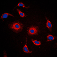 Immunofluorescent analysis of FXR2 staining in HepG2 cells. Formalin-fixed cells were permeabilized with 0.1% Triton X-100 in TBS for 5-10 minutes and blocked with 3% BSA-PBS for 30 minutes at room temperature. Cells were probed with the primary antibody in 3% BSA-PBS and incubated overnight at 4 C in a humidified chamber. Cells were washed with PBST and incubated with a DyLight 594-conjugated secondary antibody (red) in PBS at room temperature in the dark. DAPI was used to stain the cell nuclei (blue).