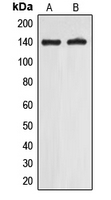Western blot analysis of EIF5B expression in A549 (A); Jurkat (B) whole cell lysates.