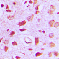 Immunohistochemical analysis of EIF5B staining in human brain formalin fixed paraffin embedded tissue section. The section was pre-treated using heat mediated antigen retrieval with sodium citrate buffer (pH 6.0). The section was then incubated with the antibody at room temperature and detected using an HRP conjugated compact polymer system. DAB was used as the chromogen. The section was then counterstained with haematoxylin and mounted with DPX.