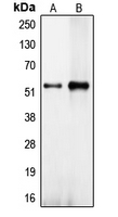 Western blot analysis of CEP57 expression in NT2D1 (A); HeLa (B) whole cell lysates.