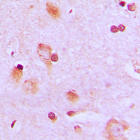 Immunohistochemical analysis of CEP57 staining in human brain formalin fixed paraffin embedded tissue section. The section was pre-treated using heat mediated antigen retrieval with sodium citrate buffer (pH 6.0). The section was then incubated with the antibody at room temperature and detected using an HRP conjugated compact polymer system. DAB was used as the chromogen. The section was then counterstained with haematoxylin and mounted with DPX.
