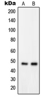Western blot analysis of GPRIN2 expression in MDAMB435 (A); K562 (B) whole cell lysates.