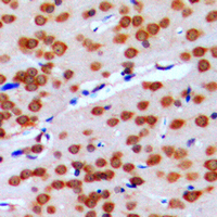 Immunohistochemical analysis of GPRIN2 staining in human brain formalin fixed paraffin embedded tissue section. The section was pre-treated using heat mediated antigen retrieval with sodium citrate buffer (pH 6.0). The section was then incubated with the antibody at room temperature and detected using an HRP conjugated compact polymer system. DAB was used as the chromogen. The section was then counterstained with haematoxylin and mounted with DPX.