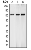 Western blot analysis of BCLAF1 expression in K562 (A); MCF7 (B); A549 (C) whole cell lysates.