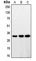 Western blot analysis of RNF144A expression in HeLa (A); HepG2 (B); Jurkat (C) whole cell lysates.
