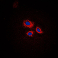 Immunofluorescent analysis of RNF144A staining in HepG2 cells. Formalin-fixed cells were permeabilized with 0.1% Triton X-100 in TBS for 5-10 minutes and blocked with 3% BSA-PBS for 30 minutes at room temperature. Cells were probed with the primary antibody in 3% BSA-PBS and incubated overnight at 4 C in a humidified chamber. Cells were washed with PBST and incubated with a DyLight 594-conjugated secondary antibody (red) in PBS at room temperature in the dark. DAPI was used to stain the cell nuclei (blue).