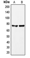 Western blot analysis of GAB2 expression in K526 (A); MCF7 (B) whole cell lysates.