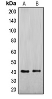 Western blot analysis of ENDOGL1 expression in Jurkat (A); HepG2 (B) whole cell lysates.