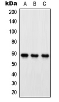 Western blot analysis of OXSR1 expression in HeLa (A); SP2/0 (B); PC12 (C) whole cell lysates.