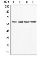 Western blot analysis of ABI1 expression in A549 (A); MCF7 (B); mouse liver (C); rat heart (D) whole cell lysates.