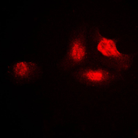 Immunofluorescent analysis of UBA2 staining in A549 cells. Formalin-fixed cells were permeabilized with 0.1% Triton X-100 in TBS for 5-10 minutes and blocked with 3% BSA-PBS for 30 minutes at room temperature. Cells were probed with the primary antibody in 3% BSA-PBS and incubated overnight at 4 C in a humidified chamber. Cells were washed with PBST and incubated with a DyLight 594-conjugated secondary antibody (red) in PBS at room temperature in the dark. DAPI was used to stain the cell nuclei (blue).