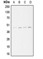 Western blot analysis of ARP3 expression in A549 (A); Jurkat (B); HeLa (C); A431 (D) whole cell lysates.