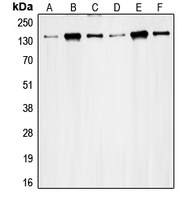 Western blot analysis of RAD50 expression in HeLa (A); K562 (B); Jurkat (C); MCF7 (D); Ramos (E); SW480 (F) whole cell lysates.