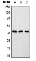 Western blot analysis of Renin Receptor expression in HeLa (A); Raw264.7 (B); rat kidney (C) whole cell lysates.