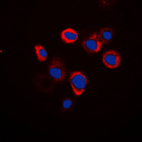 Immunofluorescent analysis of Renin Receptor staining in Raw264.7 cells. Formalin-fixed cells were permeabilized with 0.1% Triton X-100 in TBS for 5-10 minutes and blocked with 3% BSA-PBS for 30 minutes at room temperature. Cells were probed with the primary antibody in 3% BSA-PBS and incubated overnight at 4 C in a humidified chamber. Cells were washed with PBST and incubated with a DyLight 594-conjugated secondary antibody (red) in PBS at room temperature in the dark. DAPI was used to stain the cell nuclei (blue).