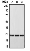 Western blot analysis of DHRS2 expression in HeLa (A); Raw264.7 (B); H9C2 (C) whole cell lysates.