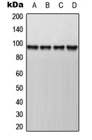 Western blot analysis of AKAP8 expression in HepG2 (A); Jurkat (B); mouse kidney (C); rat kidney (D) whole cell lysates.
