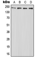 Western blot analysis of ABCA7 expression in HeLa (A); Raw264.7 (B); mouse liver (C); PC12 (D) whole cell lysates.