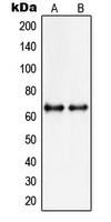 Western blot analysis of PIAS3 expression in MCF7 (A); HepG2 (B) whole cell lysates.