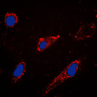 Immunofluorescent analysis of EPAC1 staining in A549 cells. Formalin-fixed cells were permeabilized with 0.1% Triton X-100 in TBS for 5-10 minutes and blocked with 3% BSA-PBS for 30 minutes at room temperature. Cells were probed with the primary antibody in 3% BSA-PBS and incubated overnight at 4 C in a humidified chamber. Cells were washed with PBST and incubated with a DyLight 594-conjugated secondary antibody (red) in PBS at room temperature in the dark. DAPI was used to stain the cell nuclei (blue).