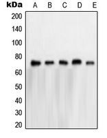 Western blot analysis of NXF1 expression in HeLa (A); A673 (B); K562 (C); Jurkat (D); A431 (E) whole cell lysates.