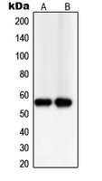Western blot analysis of TXNRD2 expression in PC12 (A); Jurkat (B) whole cell lysates.