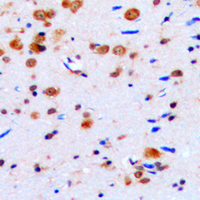 Immunohistochemical analysis of CUGBP1 staining in human brain formalin fixed paraffin embedded tissue section. The section was pre-treated using heat mediated antigen retrieval with sodium citrate buffer (pH 6.0). The section was then incubated with the antibody at room temperature and detected using an HRP conjugated compact polymer system. DAB was used as the chromogen. The section was then counterstained with haematoxylin and mounted with DPX.