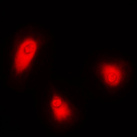 Immunofluorescent analysis of CUGBP1 staining in HeLa cells. Formalin-fixed cells were permeabilized with 0.1% Triton X-100 in TBS for 5-10 minutes and blocked with 3% BSA-PBS for 30 minutes at room temperature. Cells were probed with the primary antibody in 3% BSA-PBS and incubated overnight at 4 C in a humidified chamber. Cells were washed with PBST and incubated with a DyLight 594-conjugated secondary antibody (red) in PBS at room temperature in the dark. DAPI was used to stain the cell nuclei (blue).