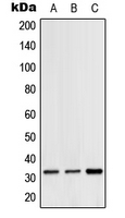 Western blot analysis of Hydrophobestin expression in HeLa (A); SP2/0 (B); H9C2 (C) whole cell lysates.