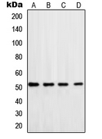 Western blot analysis of DNA Polymerase delta 3 expression in HeLa (A); MCF7 (B); Jurkat (C); mouse brain (D) whole cell lysates.