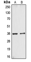 Western blot analysis of CYSLTR1 expression in A10 (A); HT29 (B) whole cell lysates.