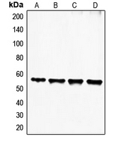 Western blot analysis of FGL2 expression in HeLa (A); Jurkat (B); HuT78 (C); Molt4 (D) whole cell lysates.
