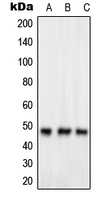 Western blot analysis of GPR83 expression in HeLa (A); Jurkat (B); HuvEc (C) whole cell lysates.